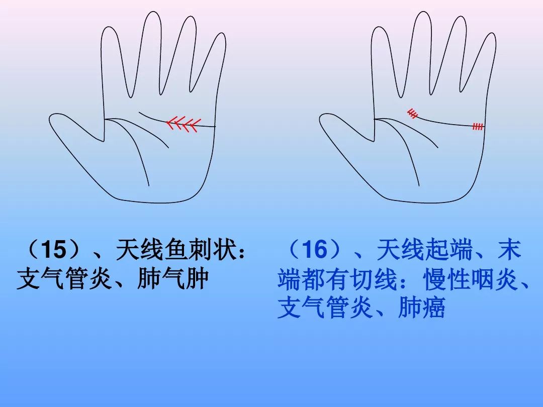 51