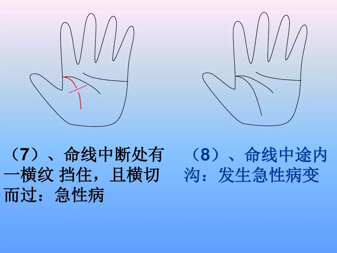 57